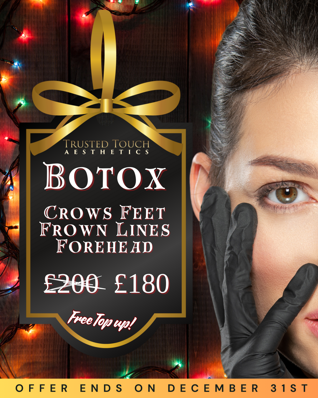 Christmas botox offer